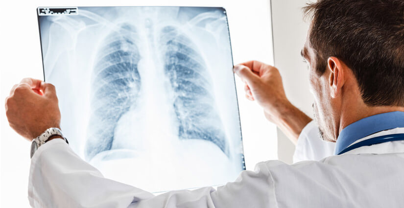 Lung Nodule Clinic